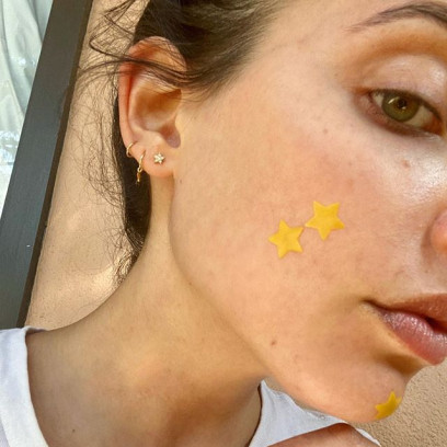 Naklejki w kształcie gwiazdek to hit na pryszcze i nowy trend na Instagramie