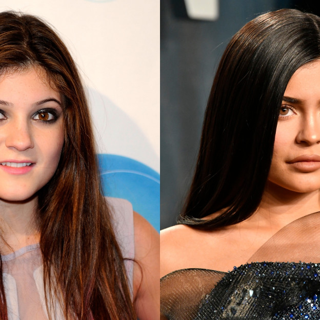 Kylie Jenner żałuje operacji plastycznych? „Nie chcę, żeby moja córka robiła to, co ja”