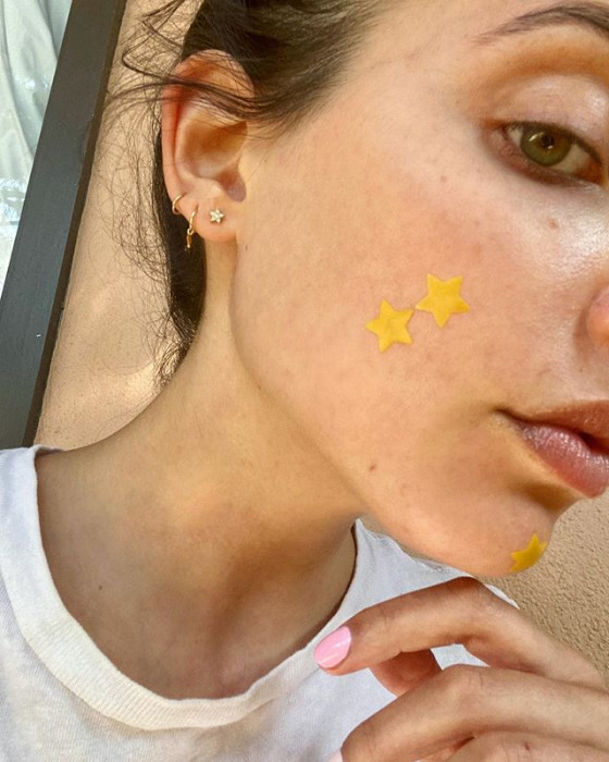 Naklejki w kształcie gwiazdek to hit na pryszcze i nowy trend na Instagramie