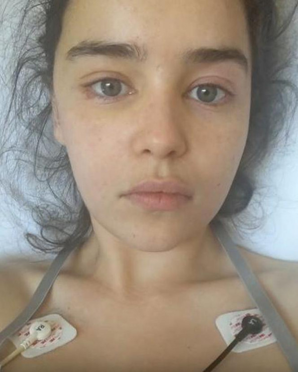Emilia Clarke w szpitalu po operacji mózgu.