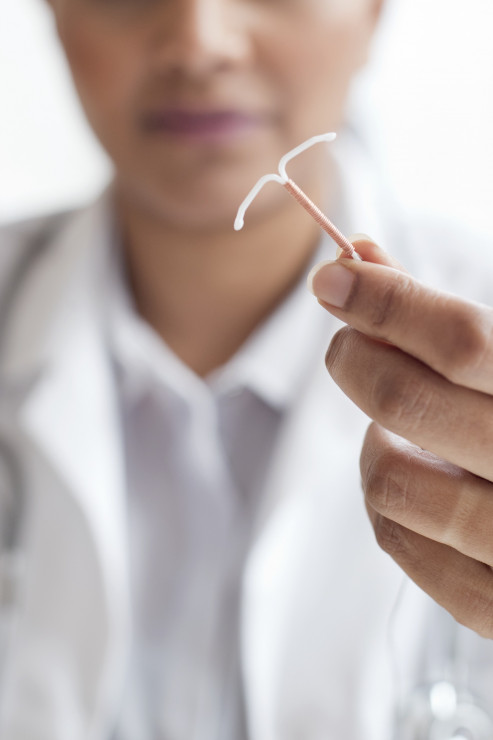 Wkładka domaciczna Mirena to metoda antykoncepcji, którą może wyłącznie założyć lekarz ginekolog!