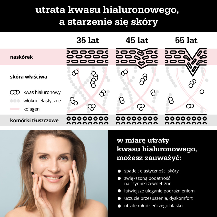 Utrata kwasu hialuronowego, a starzenie się skóry - infografika